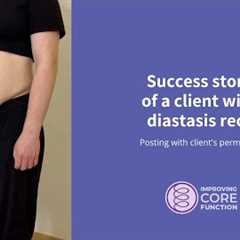 Success story of a client with diastasis recti