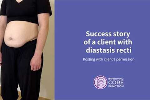 Success story of a client with diastasis recti